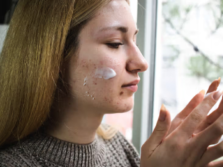 جلوگیری از خشکی پوست