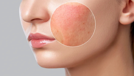 عوارض لوازم آرایش بر پوست صورت