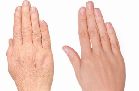 درمان خانگی دست‌های خشک