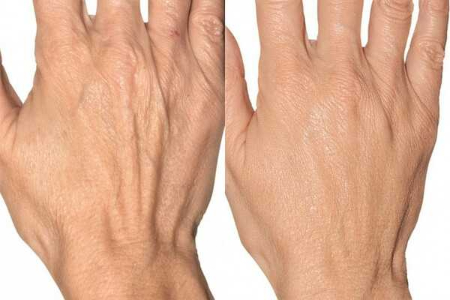 ماسک طبیعی دست