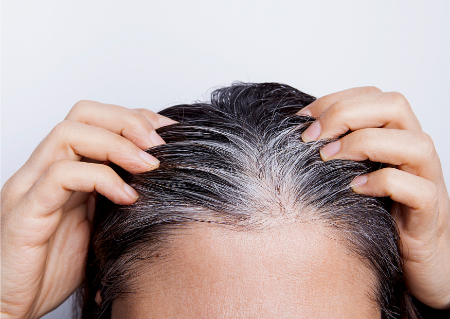 ارتباط بین تیروئید و ریزش مو