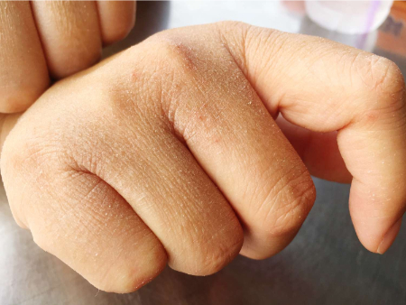 مرطوب‌کننده پوست