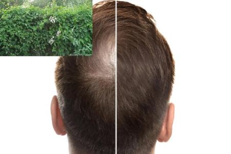 گیاهی برای رشد مجدد مو،اخبار پزشکی،خبرهای پزشکی