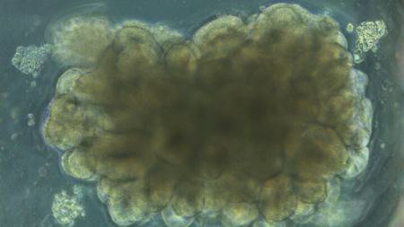 مغز،اخبار پزشکی،خبرهای پزشکی