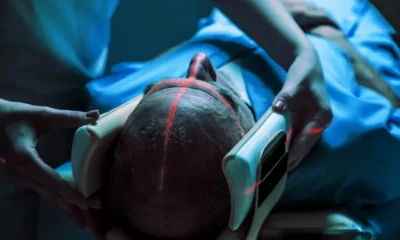 بیمارستان‌های نیویورک برای جایگزینی رادیولوژیست‌ها با هوش مصنوعی آماده می‌شوند