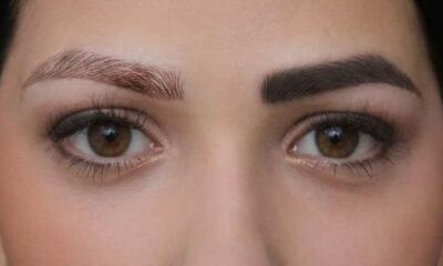 عوارض پاک کردن تاتو ابرو با لیزر {5 عوارض مهم و تجربی}
