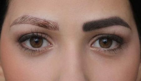 عوارض تاتو ابرو با لیزر عوارض تاتو ابرو با لیزر