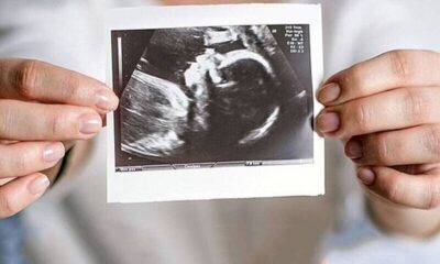 ویزیت رایگان مادران باردار ادامه دارد