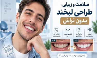 بازسازی لبخند پس از ازدست‌دادن دندان؛ از ایمپلنت تا طراحی لبخند
