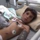 یک جراحی کم‌نظیر در بروجرد؛ دست قطع‌شده نوجوان دوباره به بدن بازگشت